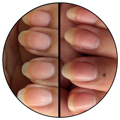 Advanced Nail Strengthener
